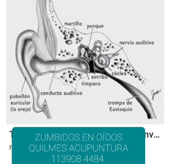Zumbidos en oídos o Tinnitus, Zona Sur Quilmes, Berazategui
